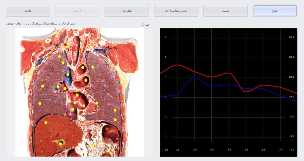 بیوفیلیا لوتوس3