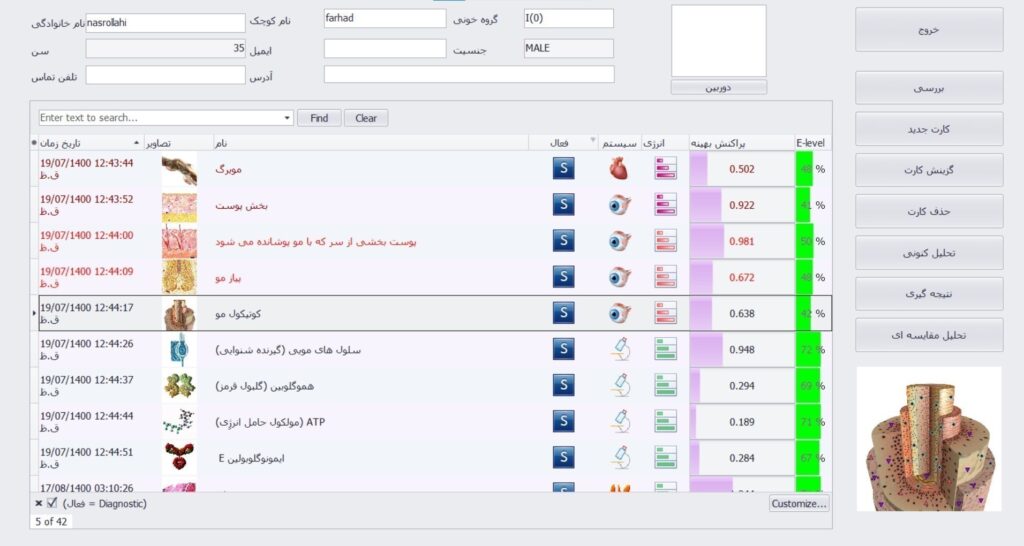 بیوفیلیا لوتوس NLS بیوفیلیا لوتوس 1
