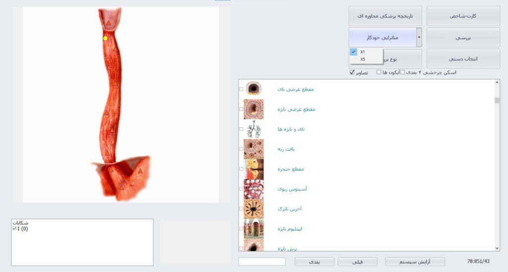 بیوفیلیا لوتوس NLS بیوفیلیا لوتوس4